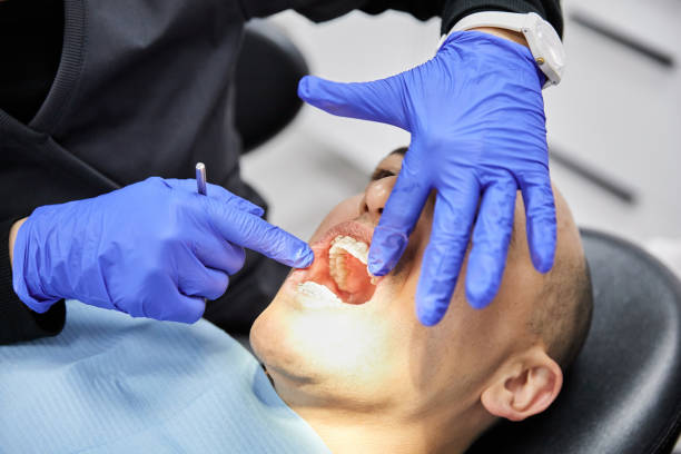 Best Broken or Cracked Tooth Emergency Dentist in Cassopolis, MI